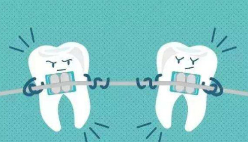 牙齿错位应该怎么矫正？