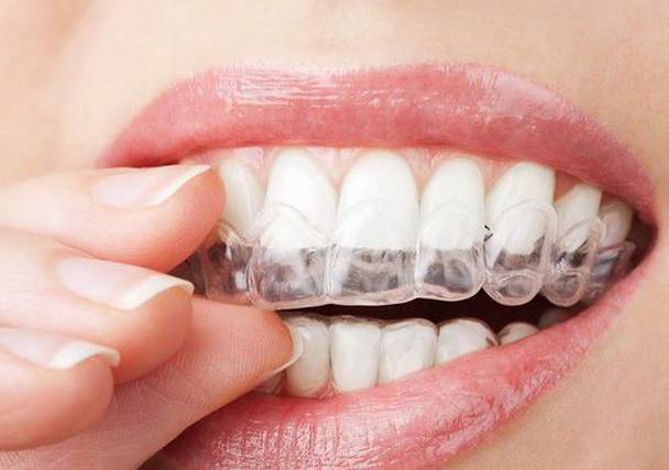 活动假牙、固定假牙的优缺点比较