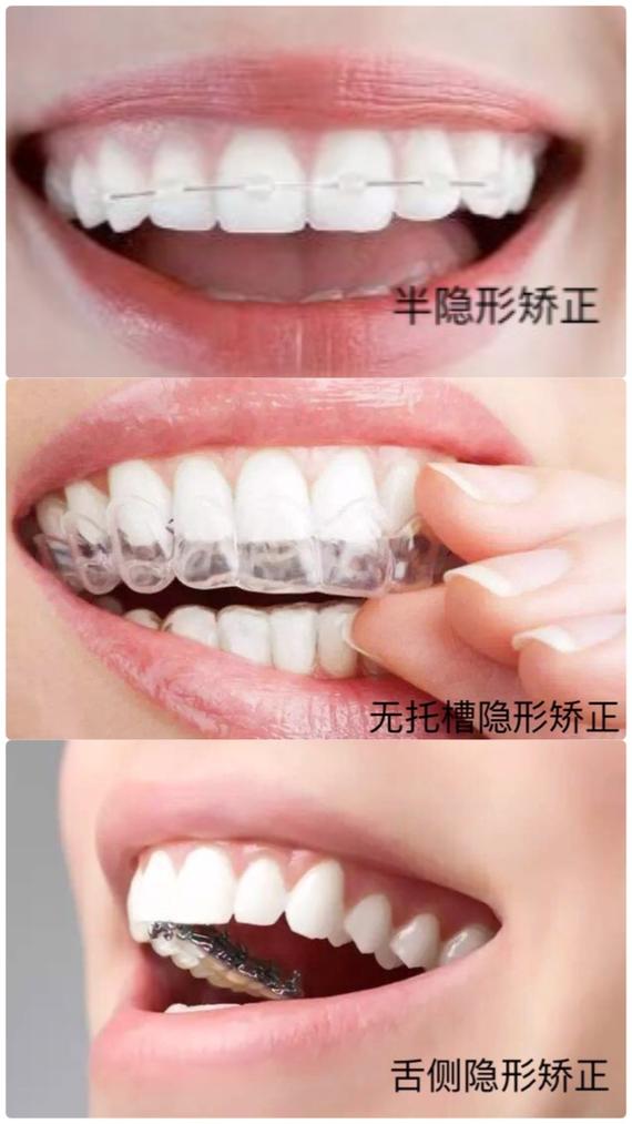 固定义齿修复后可能出现的问题及处理方法