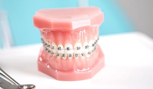 如何矫正牙齿缝隙大的烦恼？