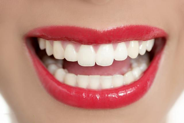 四环素牙的保健要怎么做?