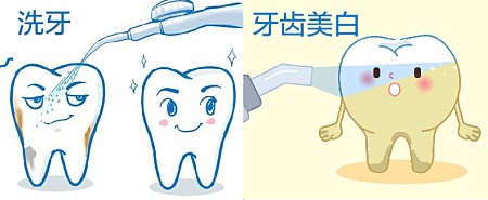 重度四环素牙治疗案例