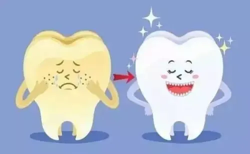 六种牙病会导致牙齿变色