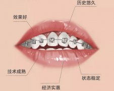 女性30岁了想要矫正牙齿晚了吗