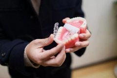 青少年牙齿龅牙矫正一般需要多少钱