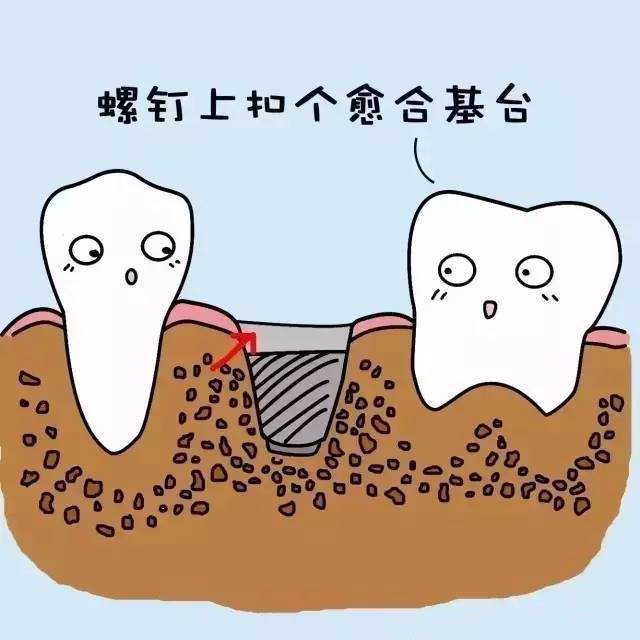 牙齿正畸术后护理