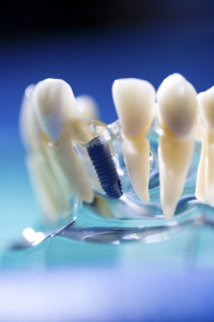 口腔美容牙齿矫正术的方法有哪些?