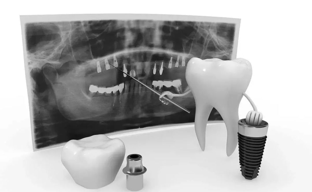 种植牙松动的原因是什么？