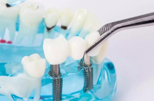 种植牙齿有危害吗?